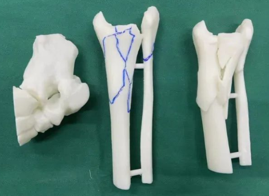 消費(fèi)級(jí)3D打印市場(chǎng)發(fā)展迎來(lái)爆發(fā)期